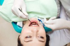 When Is It Important to Get Your Wisdom Tooth Removed?