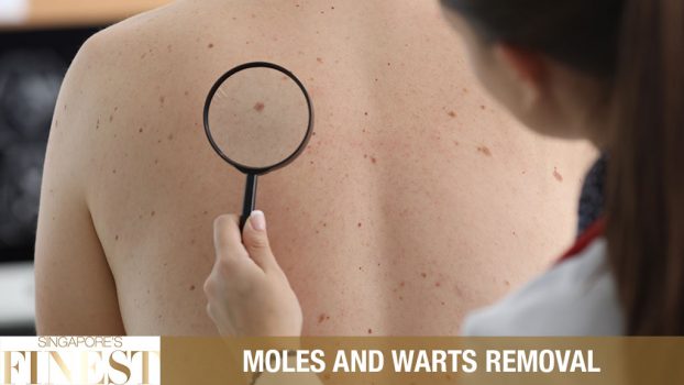 The Finest Moles and Warts Removal Centers in Singapore