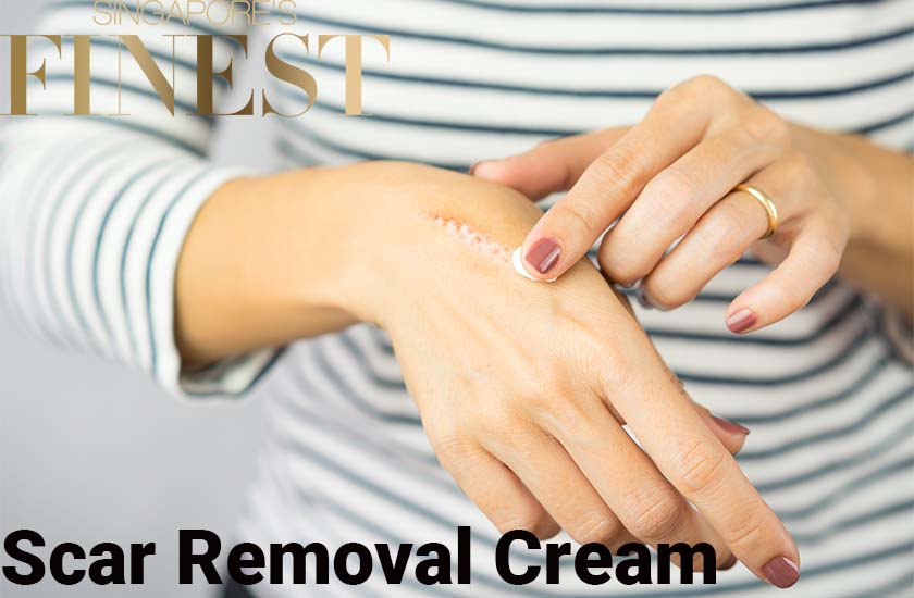 5 Best Scar Removal Creams in Singapore [2024]