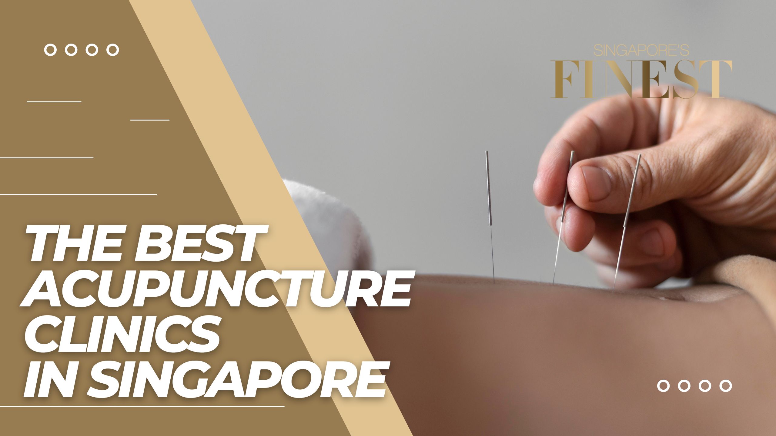 The Finest Acupuncture Clinics in Singapore