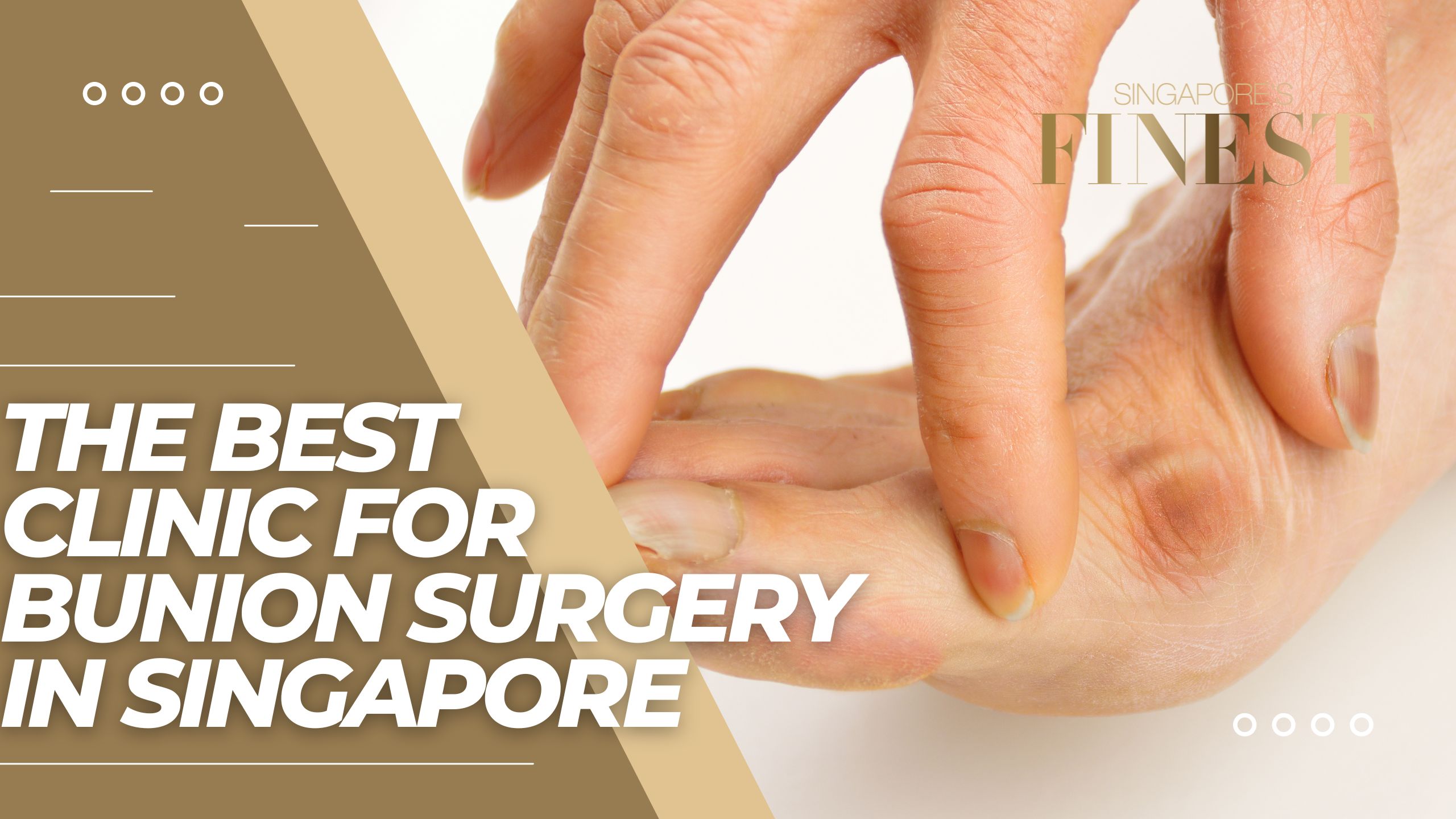 The Finest Clinics for Bunion Surgery in Singapore