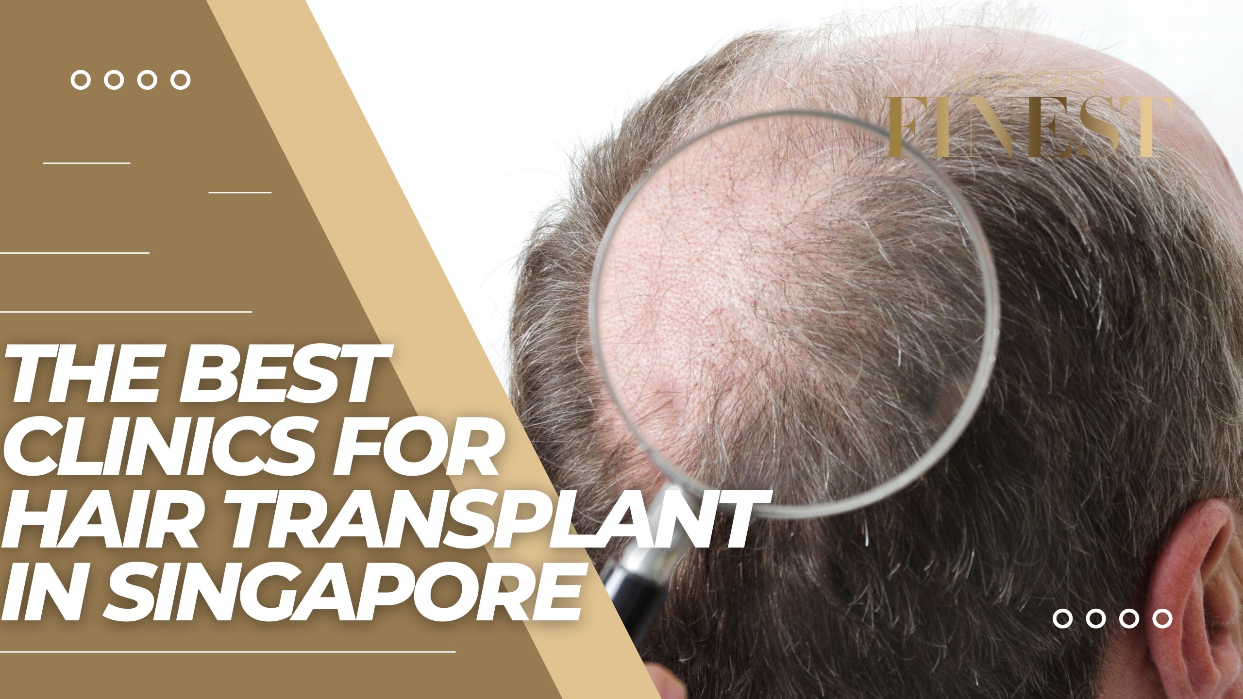 The Finest Clinics For Hair Transplant in Singapore