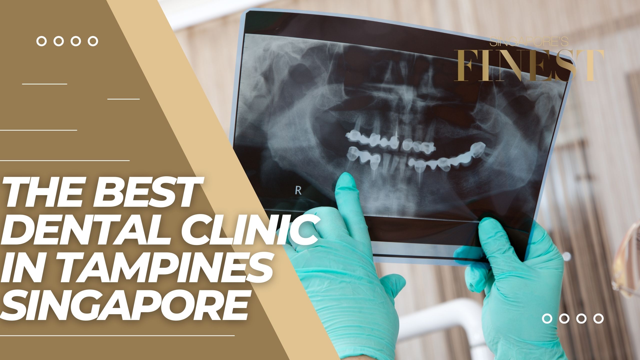 The Finest Dental Clinics in Tampines Singapore