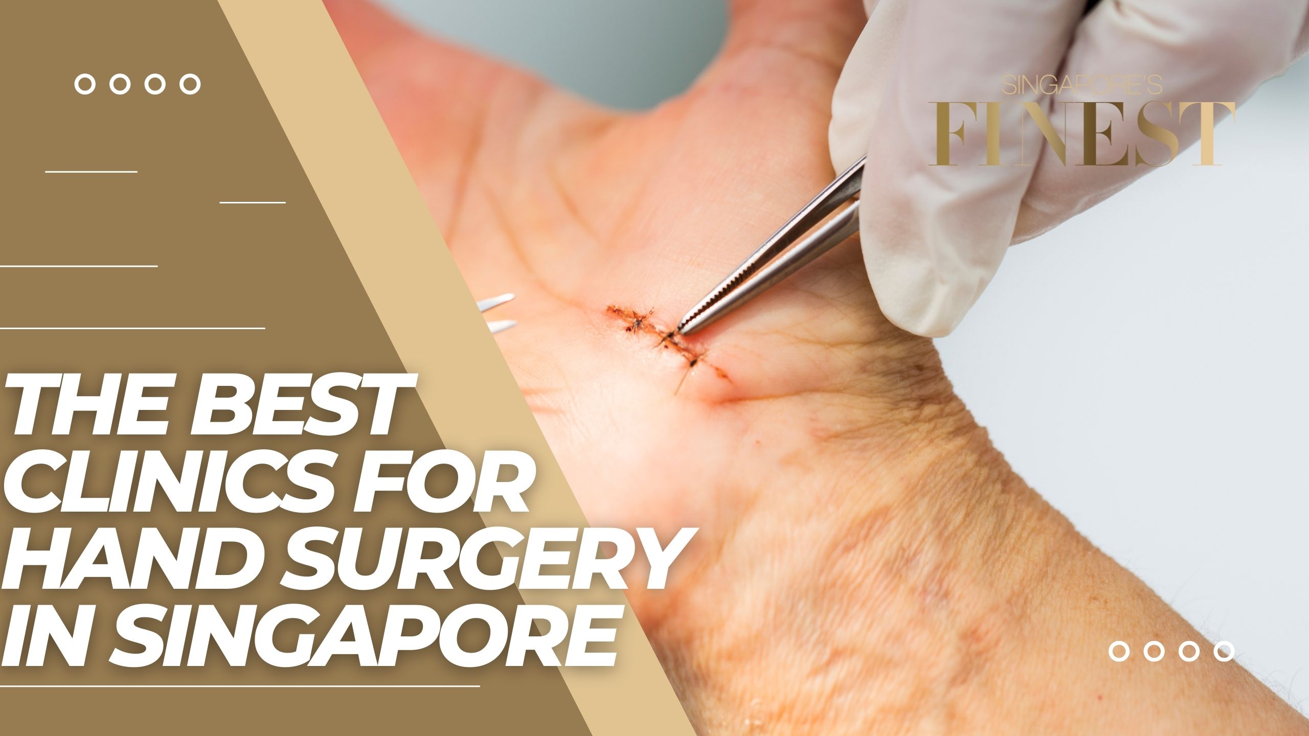The Finest Clinics for Hand Surgery in Singapore