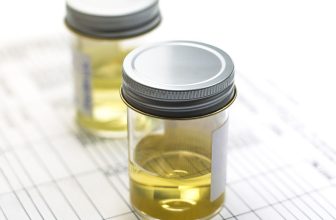 What does the colour of your pee say about your health?