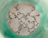 Mold Remediation vs Mold Removal: What’s the Difference?