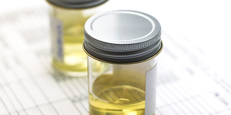 What does the colour of your pee say about your health?